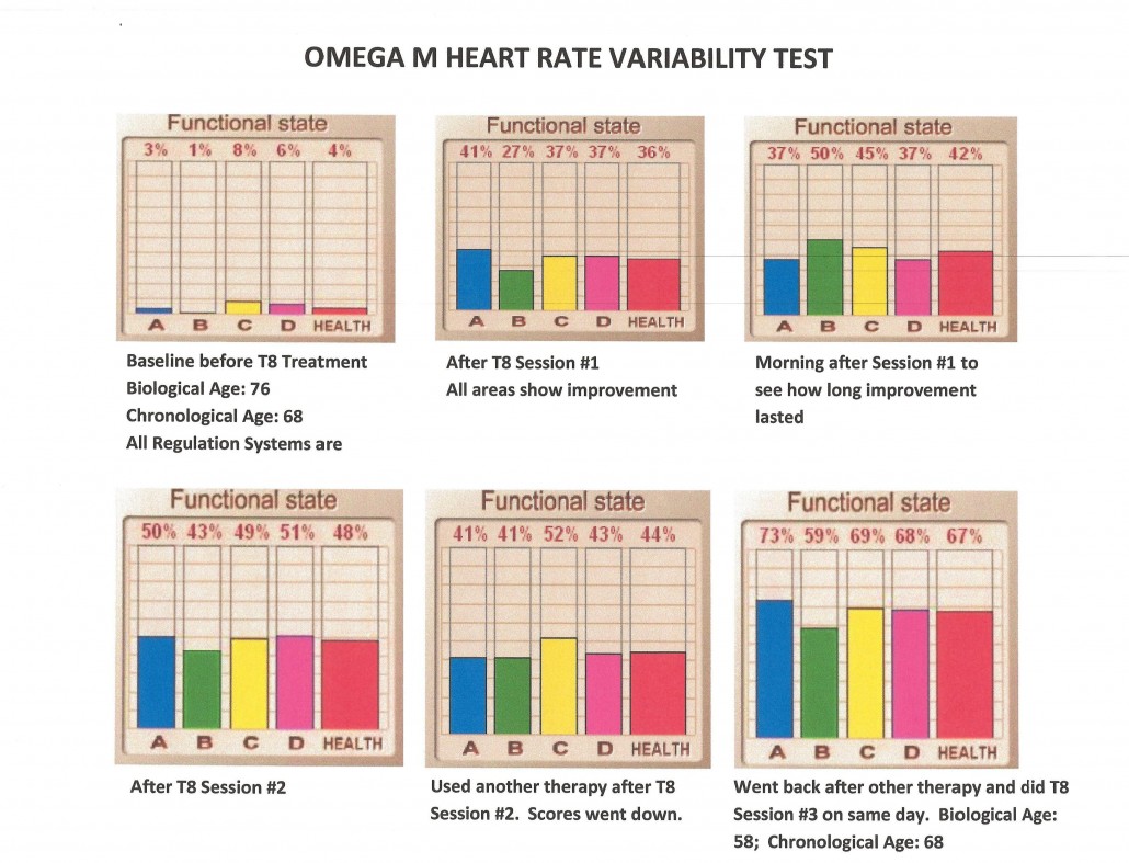 Omegawave heart rate variability chart, before and after Trinfinity8 sessions